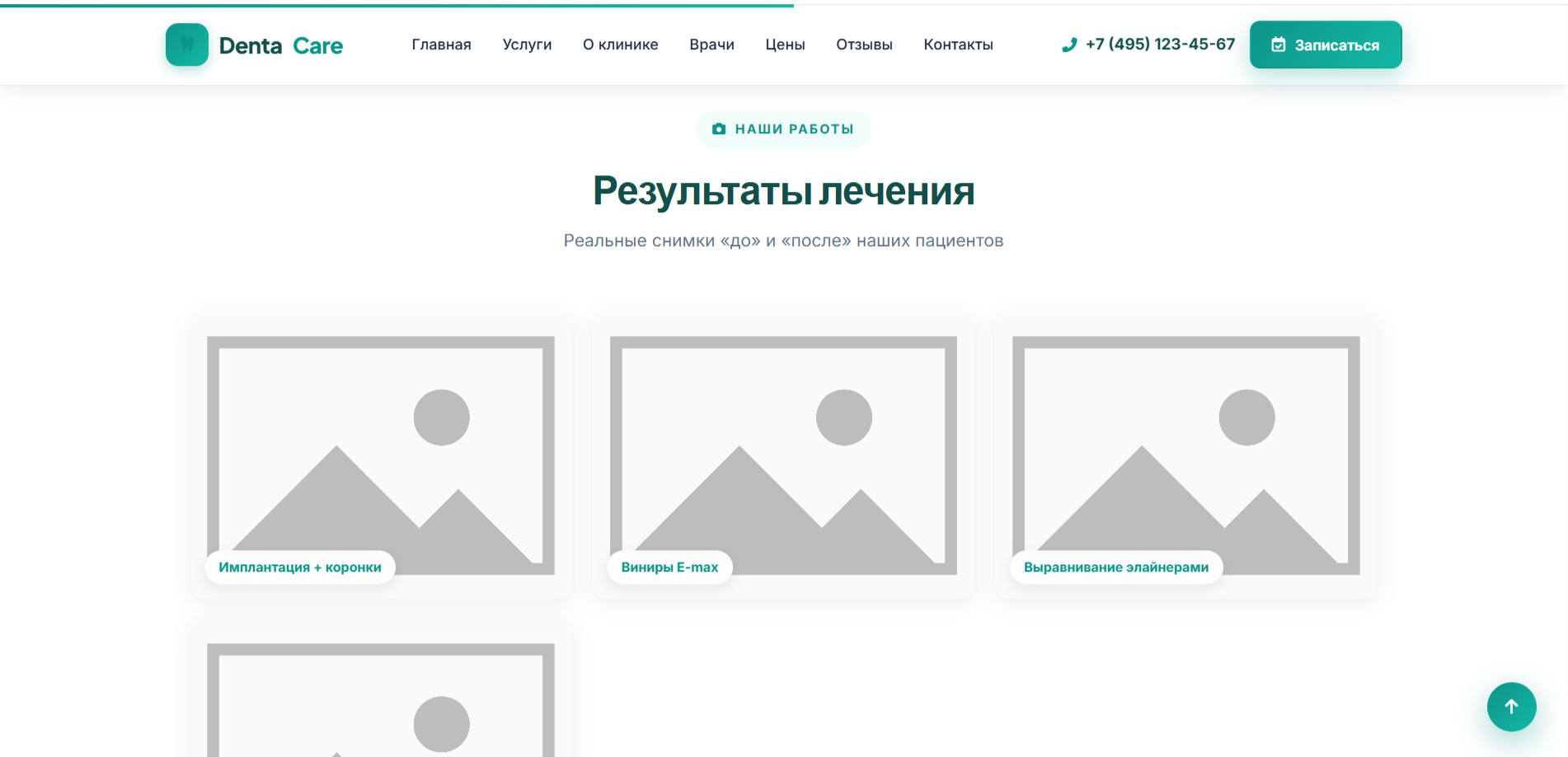 DentaCare — адаптивный HTML шаблон сайта стоматологии — изображение 7